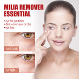 Nourish And Moisturize The Skin Around The Eyes