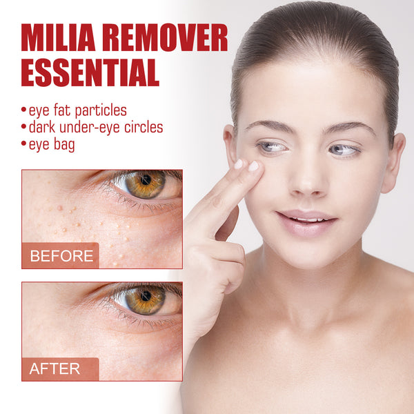Nourish And Moisturize The Skin Around The Eyes