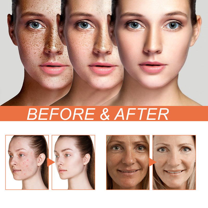 Brightening And Whitening Cream