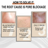 Jaysuing Lactobionic Acid Liquid Exfoliating Blackheads Shrinking Pores Cleansing Moisturizing Skin