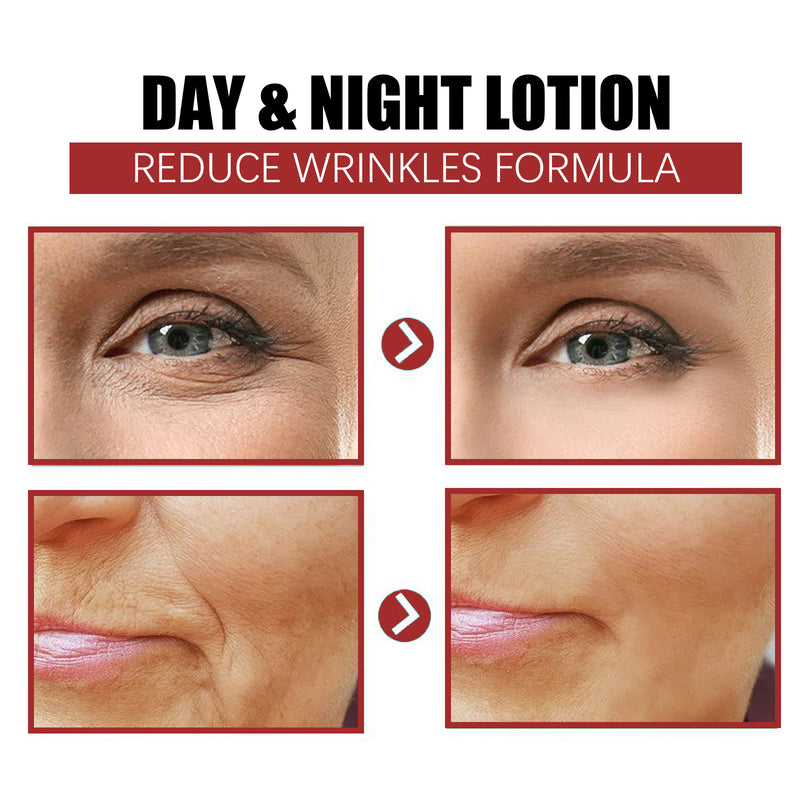 EELHOE Retinol Moisturizing Face Cream Lifts And Tightens Skin