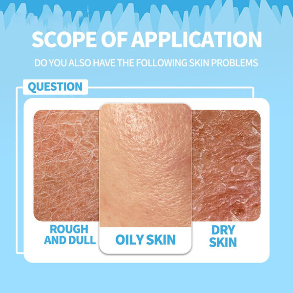 Yifuquan Moisturizing Sleeping Mask, Hydrating And Repairing Dry And Dull Spots On The Face